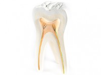 ROOT CANALS